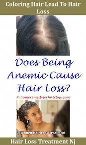 Hair Loss And Baldness Hair Loss 7 Matt Damon Hair Loss Best Natural Solution To Hair Loss Hai Hair Loss Solutions Hair Loss Clinic Hair Loss Women Treatment