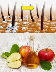 The short answer is no. 50 Uses For Apple Cider Vinegar That Can Make Your Life Easier