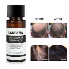 Keep the oil on for few hours and then wash with warm water. Lanbena Ginger Hair Growth Essential Oil Prevent Hair Loss Shopee Philippines