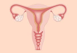 Signs You Have An Ovarian Cyst And What To Do About It – Cleveland Clinic