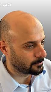 Tato The Picasso Cash