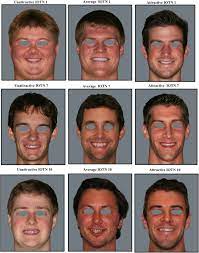 Talking to the woman you're interested in can turn that 7 into a perfect 10. Objective Assessment Of The Contribution Of Dental Esthetics And Facial Attractiveness In Men Via Eye Tracking Sciencedirect