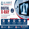Digital X-Ray product image