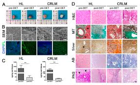 Colorectal cancer comes back in about half of people who have surgery to remove the cancer.footnote 3 the cancer may be more likely to come. Cancers Free Full Text Patient Derived Scaffolds Of Colorectal Cancer Metastases As An Organotypic 3d Model Of The Liver Metastatic Microenvironment