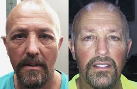 Gallery — DR BENJAMIN BURT