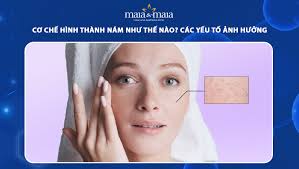 Cơ chế hình thành nám như thế nào? Các yếu tố ảnh hưởng