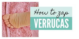 Its hard to completely avoid coming into contact with hpv but there are some precautions that may help to prevent them from spreading or developing, like: Get Rid Of Verrucas Naturally