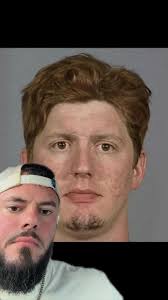 Faces of addiction 😱 #rehab #fyp #addiction #awareness #recovery #viral  #fblifestyle