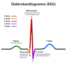 Ekgs can be used to diagnose heart attacks, heart problems including electrical malfunctioning and other heart problems. Ekg Anwendungsgebiete Funktionsweise Ablauf