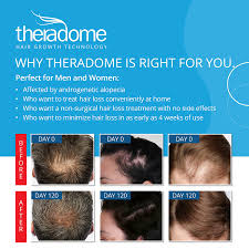 This works wonders in helping women suffering from vitamin deficiency in regrowing their hairs. Buy Theradome Pro Laser Hair Growth Helmet Lh80 Light Therapy For Hair Regrowth And Hair Loss Treatment Fda Cleared For Men Women Made To Exacting Standards In The