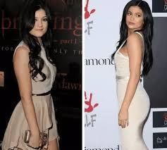 Kylie jenner surgery claims sweep the internet on a regular basis, usually after the star posts yet another sultry instagram picture. Kylie Jenner S Body Before And After Implants Photos
