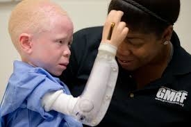 Check spelling or type a new query. These Albino Children Hunted In Africa Will Break Your Heart