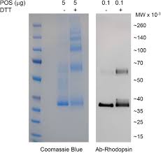 Degradation of Photoreceptor Outer Segments by the Retinal Pigment  Epithelium Requires Pigment Epithelium-derived Factor Receptor (PEDF-R)