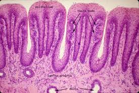 Image result for Filiform Papillae