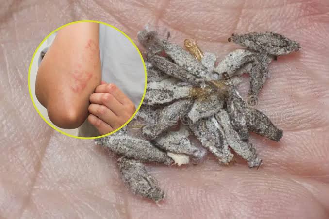 Kamitetep looks harmless, but this common household pest can trigger  painful rashes