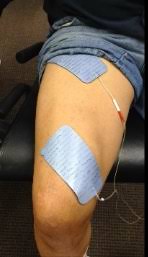 5 Common Mistakes For Neuromuscular Electrical Stimulation