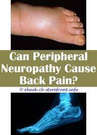 10 Graceful Peripheral Neuropathy Food Ideas
