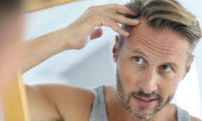 By allowing your body to generate higher dihydrotestosterone amounts, steroids are believed to cause male hair loss (dht). Steroids And Hair Loss Fitness Gurls Magazine