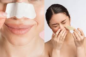 Mụn chỉ là gì? Bí kíp điều trị mụn sợi chỉ hiệu quả tại nhà