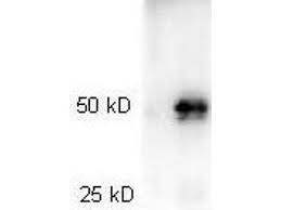 Anisakis, igg антитела к возбудителю анизакидоза (нематодам рода anisakis), igg. Goat Anti Rabbit Igg Heavy Light Chain Antibody Hrp Abin964977