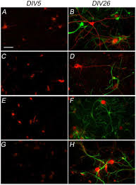 AMPA receptor expression is predominant in neuronal cells. Double... |  Download Scientific Diagram