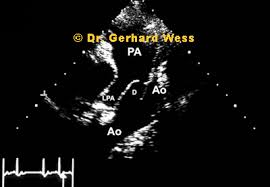 This is an optional field that can be used in place of your member number that you will receive once you complete the enrollment process. Pda Persistierender Ductus Arteriosus Bei Hunden Und Katzen Informationenseiten Der Abteilung Fur Tierkardiologie Universitat Munchen