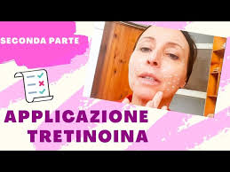 Prodotti Skincare Low Cost 💰