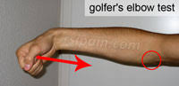 It may also be referred to as pitcher's elbow, or termed. Tennis Elbow