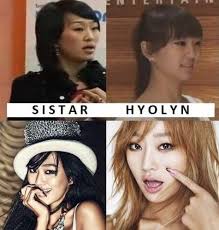 K Pop Female Idols Before And After Plastic Surgery Plastic Surgery Idol Surgery