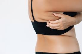 Image result for Liposuction