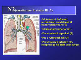 10 mm per i linfonodi ovoidali, 8 mm per quelli arrotondati. Diagnosi E Stadiazione Del Tumore Polmonare Ppt Video Online Scaricare
