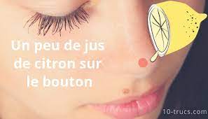 Bouton Sur Le Nez 10 Trucs Pour L Enlever