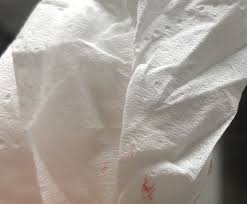 It is a pregnancy loss in the first 12 weeks of pregnancy that might happen due to genetic or chromosomal defects, and also. Anyone Had This Type Of Bleeding And It S Not Ended In Miscarriage Mumsnet