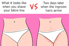 What went viral in june. 23 Things You Should Know About Pubic Hair