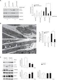 Art cache:87byrsbyhgyj:www infobiografias com/biografia/30046/keanu reeves html como se prepara la semilla de aguacate para abortar remedio cacero para quitar la teta pornodeinfantil mi bebé me tiene pelada el pico de la teta como se curar mi pico de la teta de forma natural testing%\' and 2*3*8=6*8. Autophagy Induction In Atrophic Muscle Cells Requires Ulk1 Activation By Trim32 Through Unanchored K63 Linked Polyubiquitin Chains Science Advances