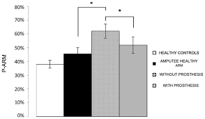 Maybe you would like to learn more about one of these? Amputation And Prosthesis Implantation Shape Body And Peripersonal Space Representations Scientific Reports