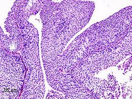 Bladder cancer is a disease that affects a handful of cats every year. Transitional Cell Carcinoma Wikipedia