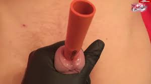 Me Taking the Maximum Urethral Sound: Big Cock Porn | xHamster