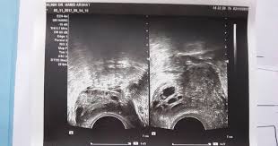 Kini badan akur untuk mendapatkan rawatan di klinik pakar dr. Rahsia Dr Hamid Arshat 1st Appointment