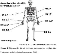 Epidemiological Endocrine And Metabolic Features In Turner Syndrome