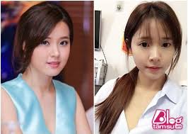 Bị nghi phẫu thuật thẩm mỹ, Midu chốt một câu khiến ai cũng méo mặt