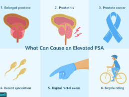 The psa test is more effective than the digital rectal exam in detecting cancer, but the dre sometimes picks up cancers the blood test misses. Understanding Your Psa Results