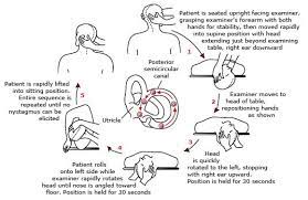 Starting the home epley maneuver. Epley Maneuver Pi