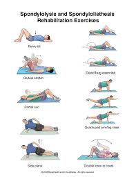 Spinal Osteoarthritis Spondylosis Exercises I Also Recommend Hip Openers Like Pigeon To Relieve The Pin Spondylolisthesis Rehabilitation Exercises Exercise