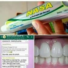 Pasta Gigi Nasa 100 Asli Odol Nasa Asli Lazada Indonesia