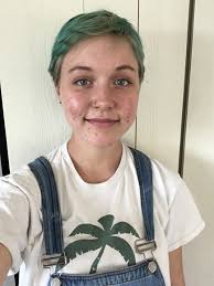 Question! I need help I'm so desperate. I stopped wearing face makeup years  ago to try and clear up my skin. And now I just don't ever wear makeup. But  it's also