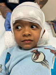 Boystown Hospital 24-hour EEG experience