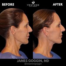 Dr. James D. Goggin added a new photo.