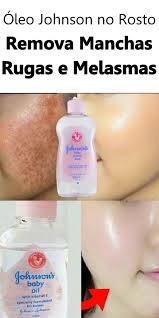 Oleo Johnson No Rosto Remova Suas Manchas Rugas E Melasmas Johnson Baby Oil Baby Oil Beauty Health