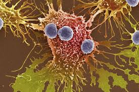 What exactly should you be looking for? Tumor Mutational Burden Can Help Predict Response To Immunotherapy In Many Different Cancers Memorial Sloan Kettering Cancer Center